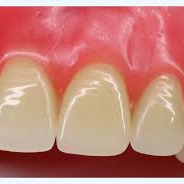 next dental radio